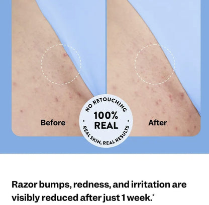 Purethic Glide & Glow: Ingrown Hair Treatment for Smooth, Radiant Skin